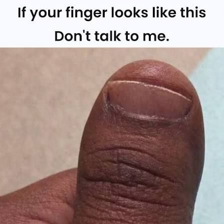 User submitted image